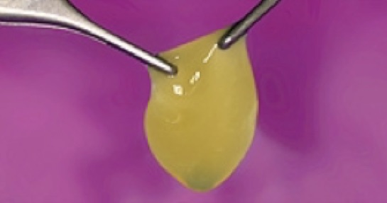 prgf 06