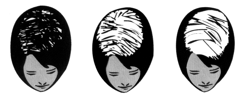 Trapianto di Capelli