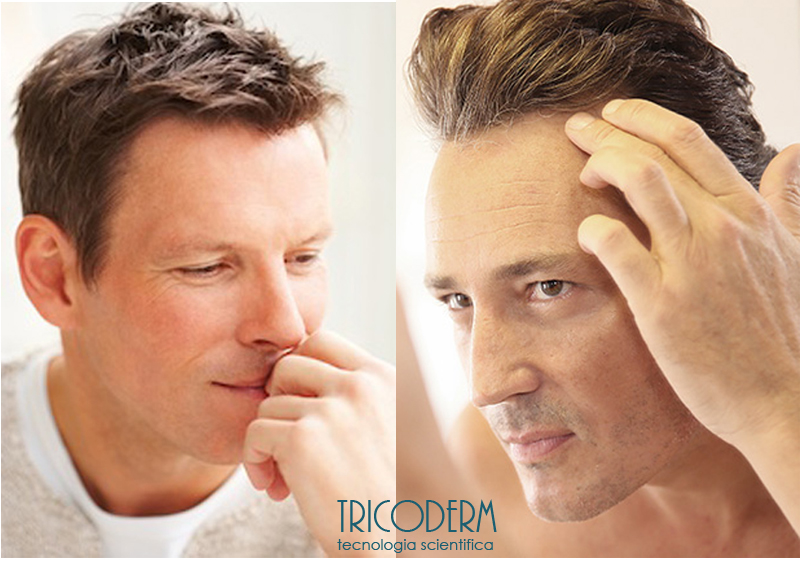 Capelli senza Chirurgia