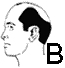 Testa B